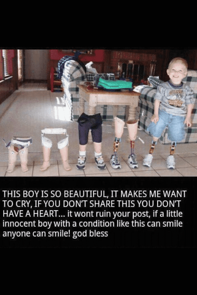 kid with no legs smiling